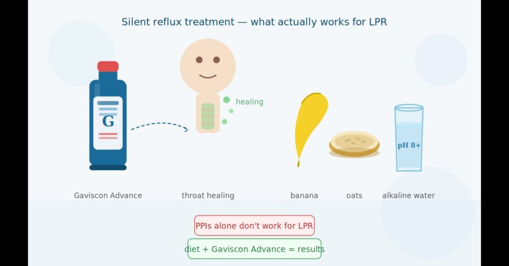 silent reflux treatment