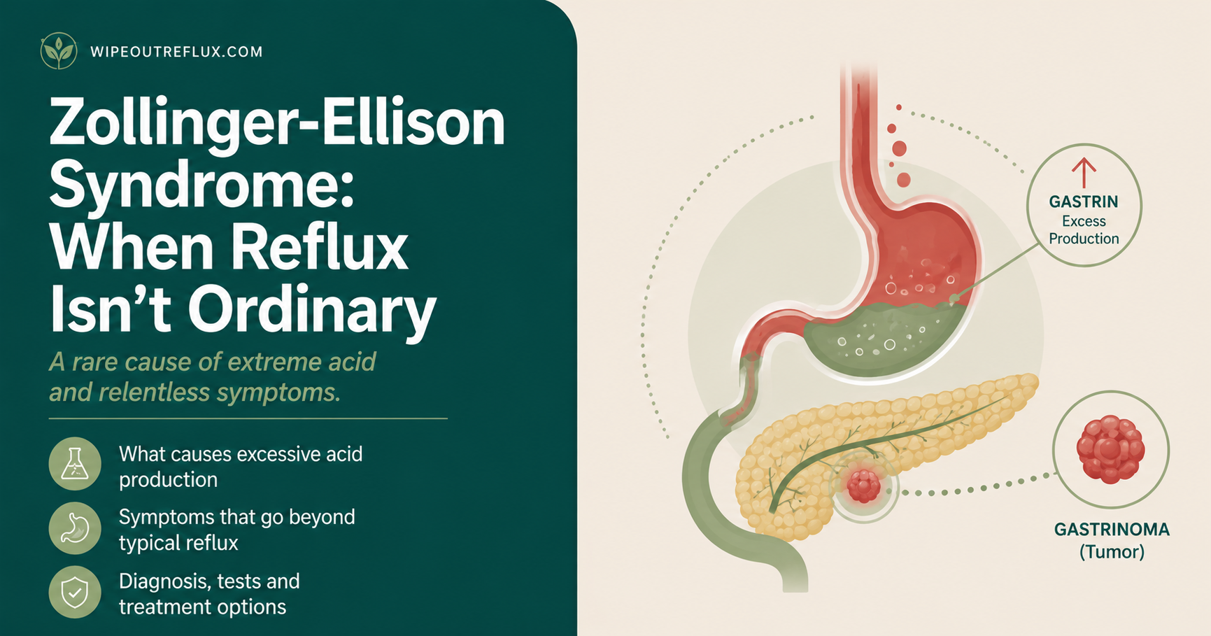 Zollinger-Ellison Syndrome