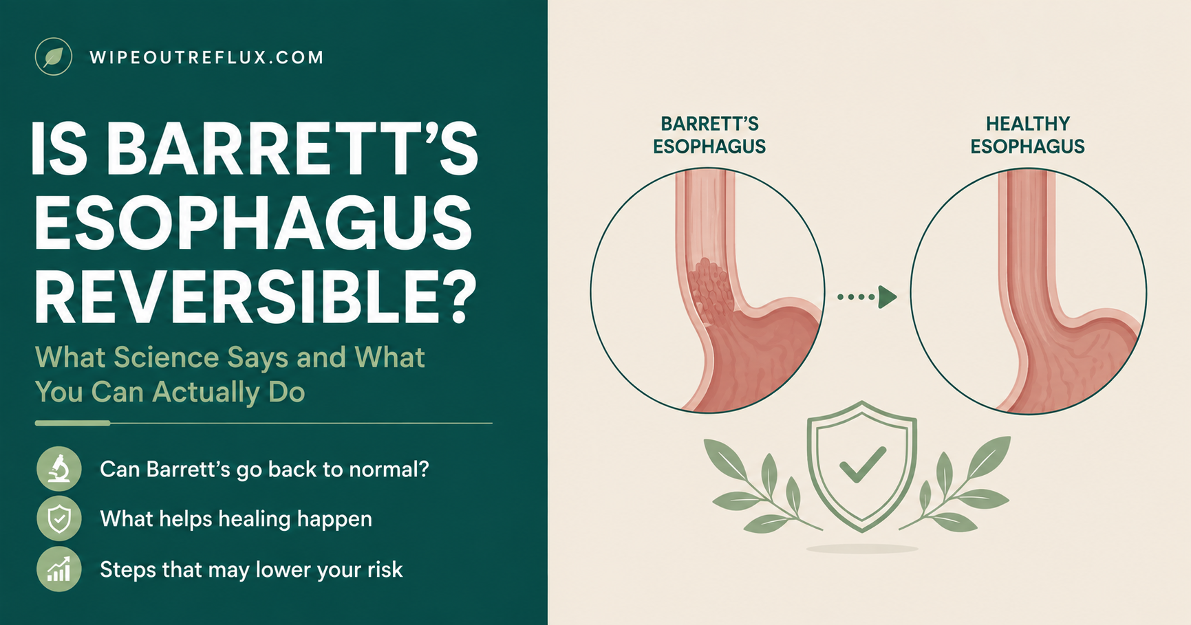 barretts