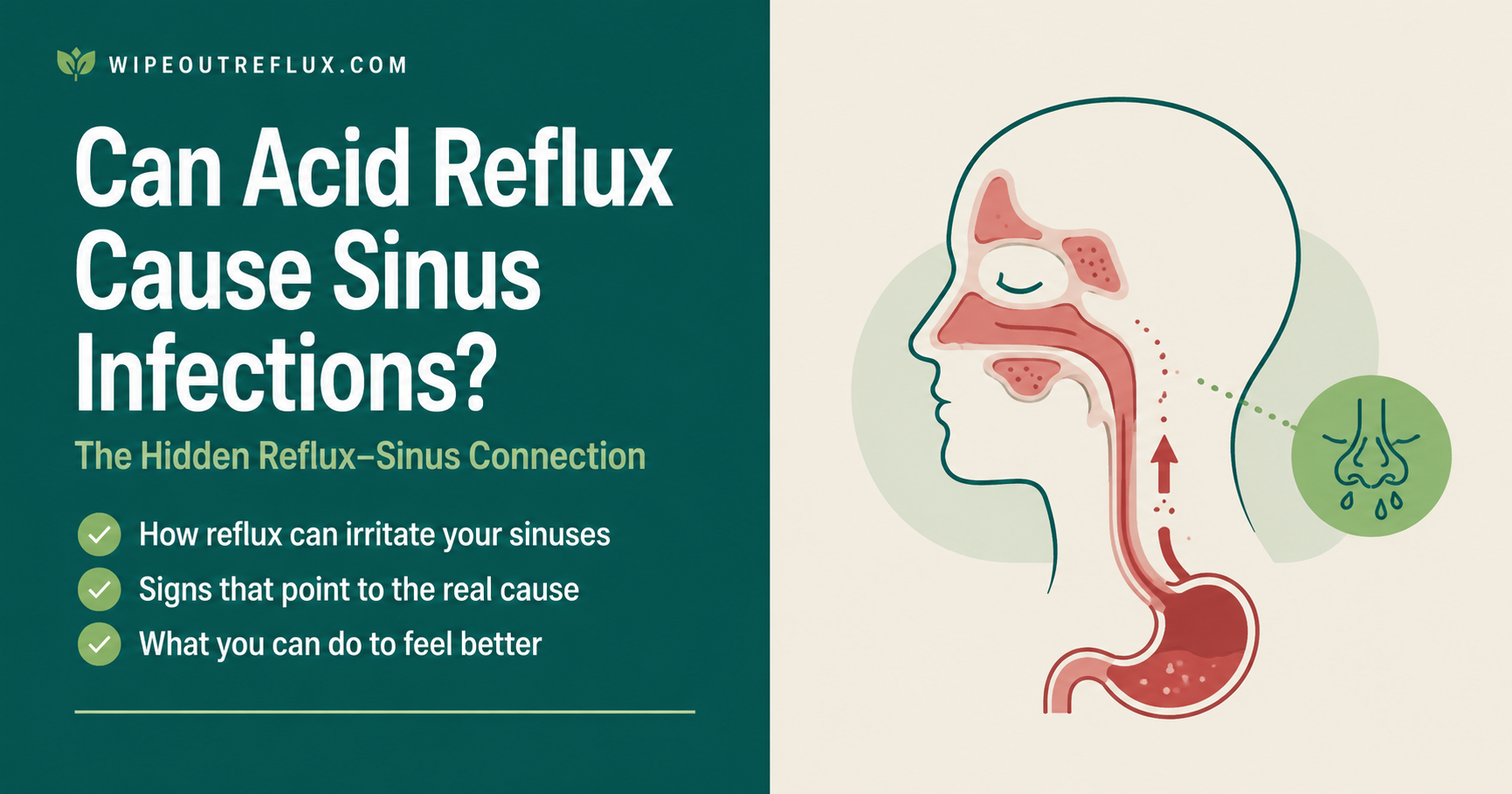 can acid reflux cause sinus congestion