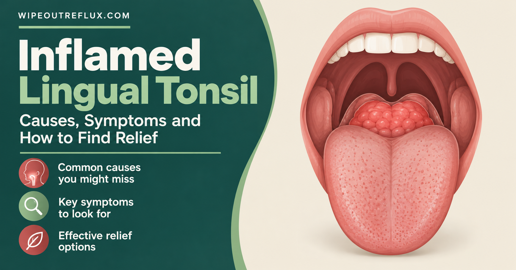Inflamed lingual tonsil