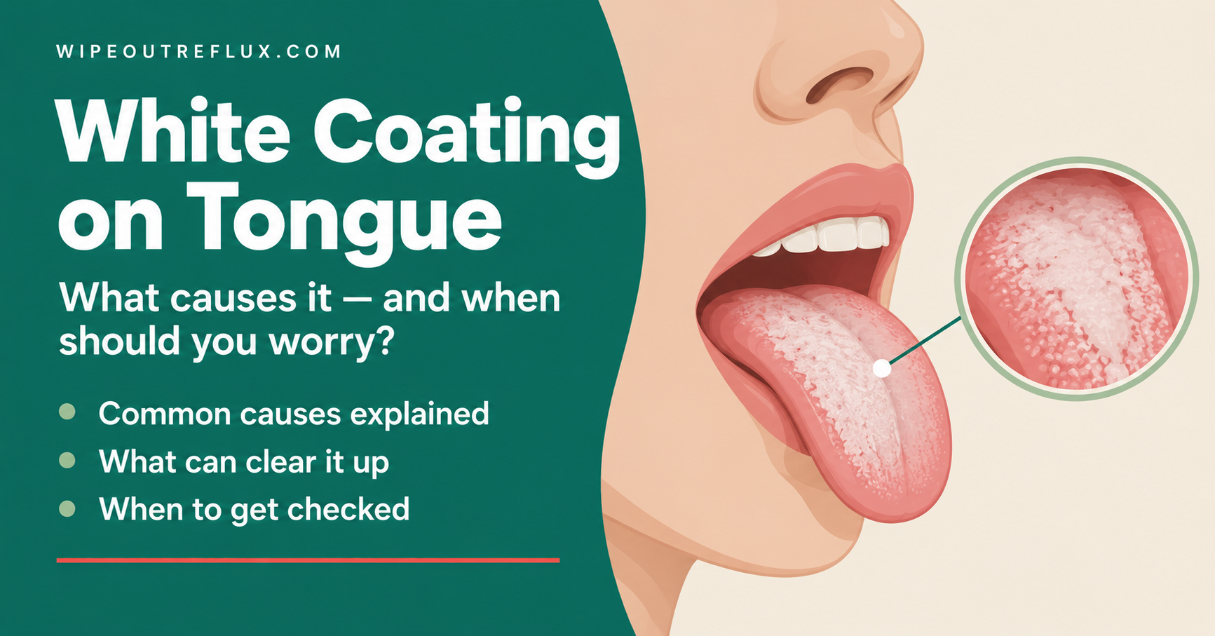 White coating on tongue